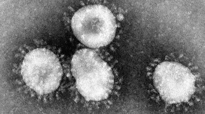 : Coronaviruses are a group of viruses that have a halo, or crown-like (corona) appearance when viewed under an electron microscope